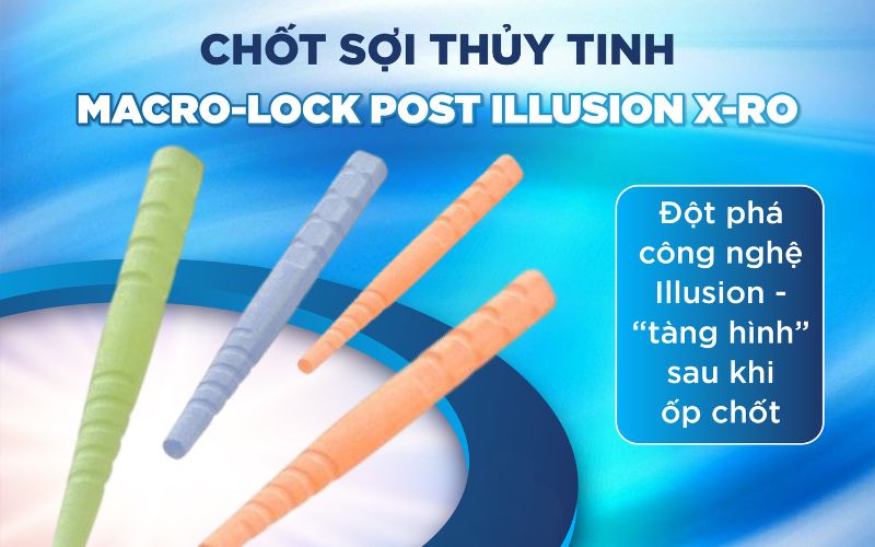 Chốt sợi thủy tinh Macro-Lock Post Illusion X-RO sở hữu công nghê đổi màu Illusion độc quyền của RTD