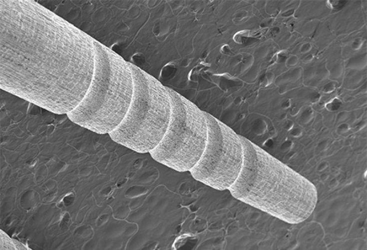 Chốt sợi thủy tinh Macro-Lock Post Illusion X-RO - Ảnh 7