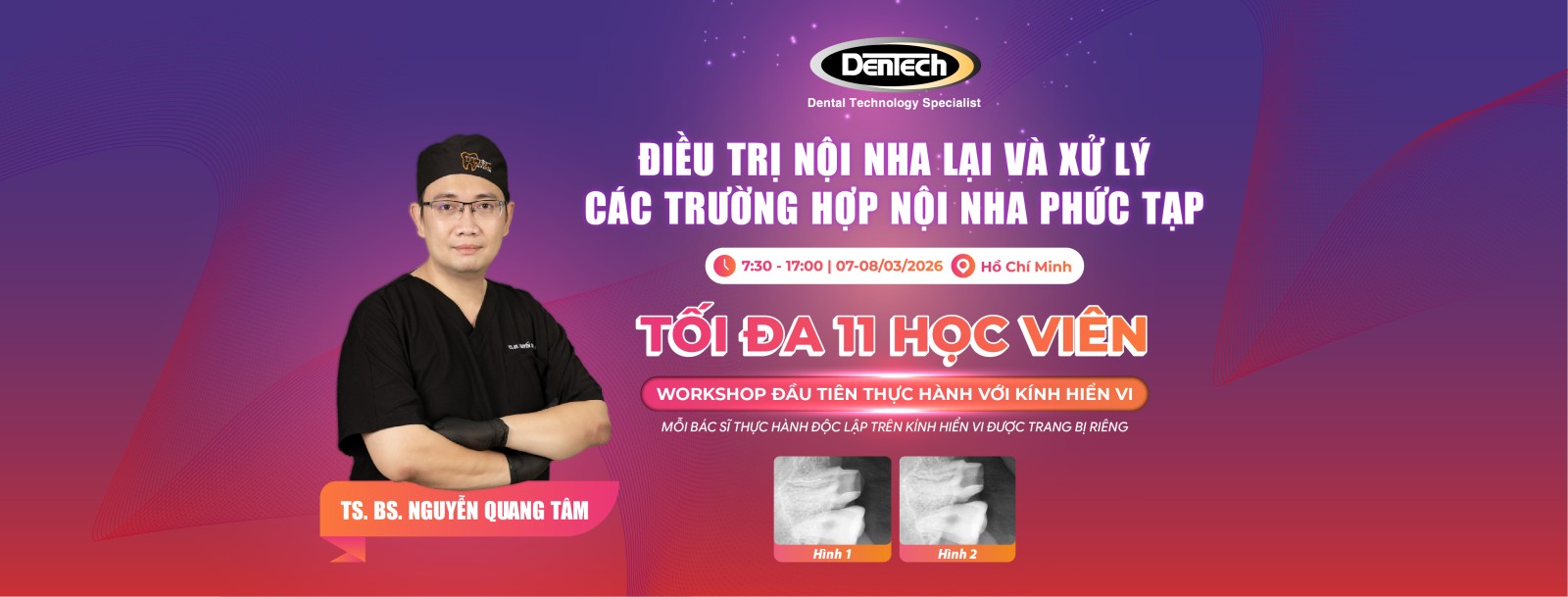 ĐIỀU TRỊ NỘI NHA LẠI VÀ XỬ LÝ CÁC TRƯỜNG HỢP NỘI NHA PHỨC TẠP TS. BS. Nguyễn Quang Tâm