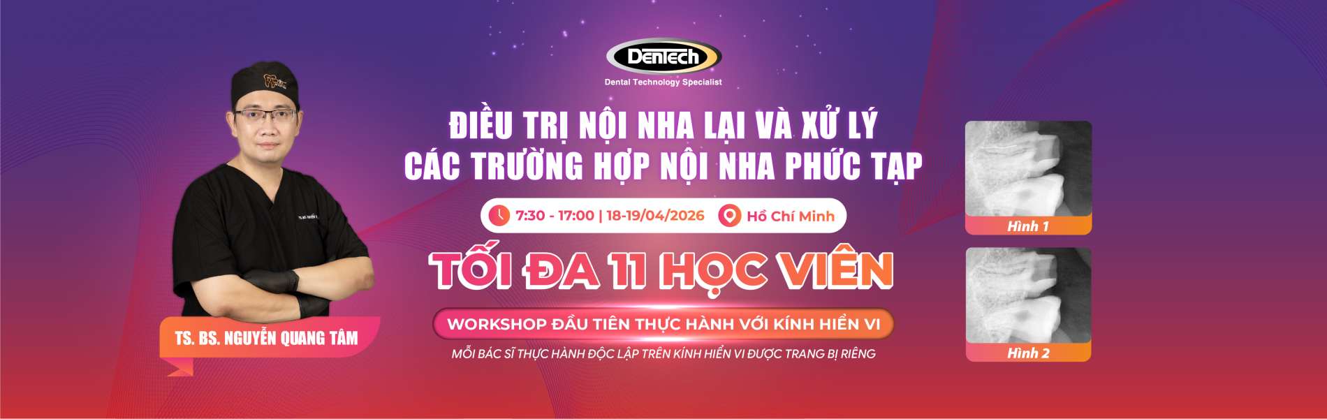 ĐIỀU TRỊ NỘI NHA LẠI VÀ XỬ LÝ CÁC TRƯỜNG HỢP NỘI NHA PHỨC TẠP