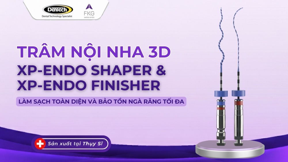 Trâm nội nha 3D: bí quyết làm sạch toàn diện và bảo tồn ngà răng tối đa