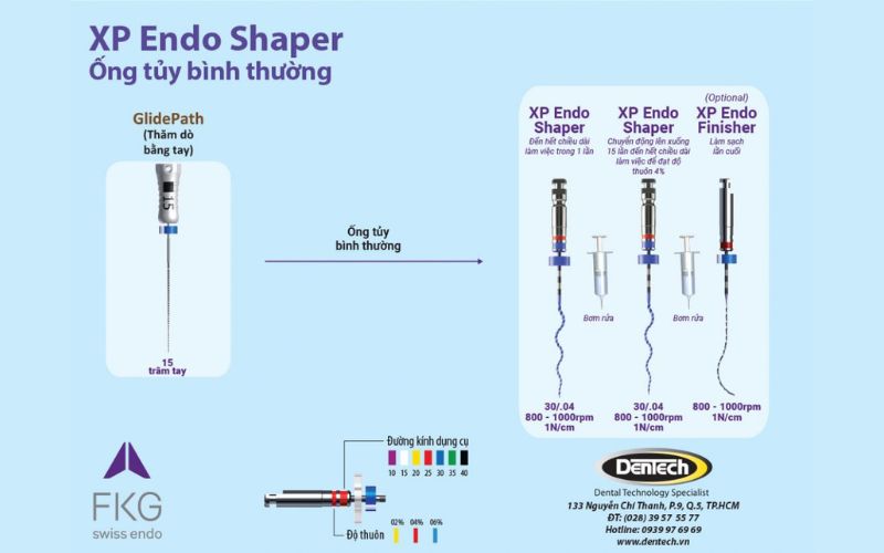 XP-endo Shaper: sự kết hợp hoàn hảo giữa tốc độ và tính an toàn
