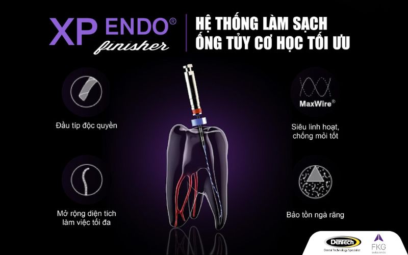 XP-endo Finisher: bước hoàn thiện cuối cùng cho vùng giải phẫu phức tạp
