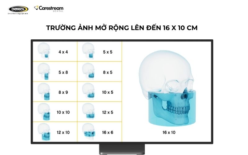 Máy chụp X-quang CS 8200 3D 2