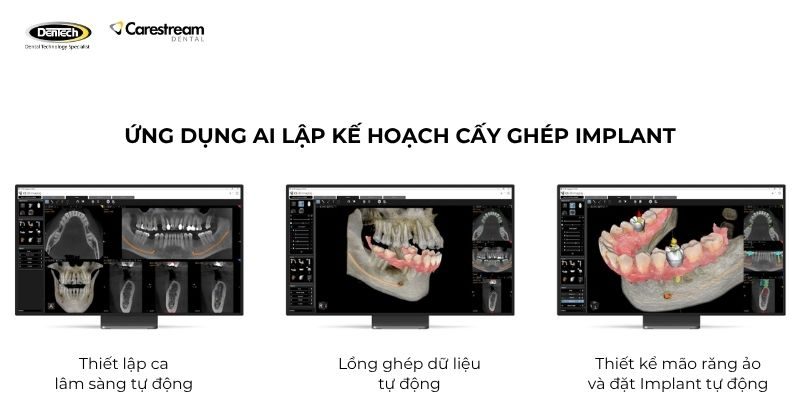 Máy chụp X-quang CS 8200 3D 3