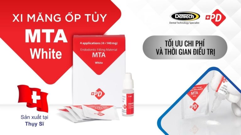 Xi măng nội nha PD MTA White: tiêu chuẩn Thụy Sĩ giúp bảo tồn răng và tối ưu thẩm mỹ